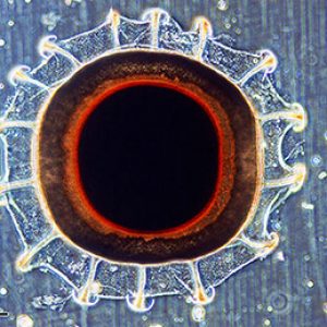 Bryozoan examples with corresponding letters