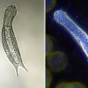 Worm like organisms under magnification