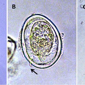 Microscopic organisms with corresponding letters